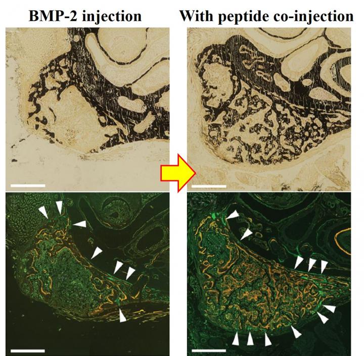 Image 2: Microscopic Views of Newly Formed Bone