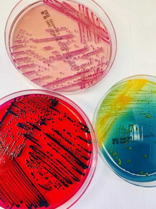 Growth of bacterial cultures in Petri dishes
