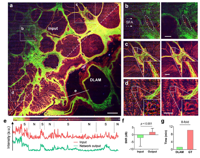 Deep learning-enhanced autofluorescence-harmonic imaging.