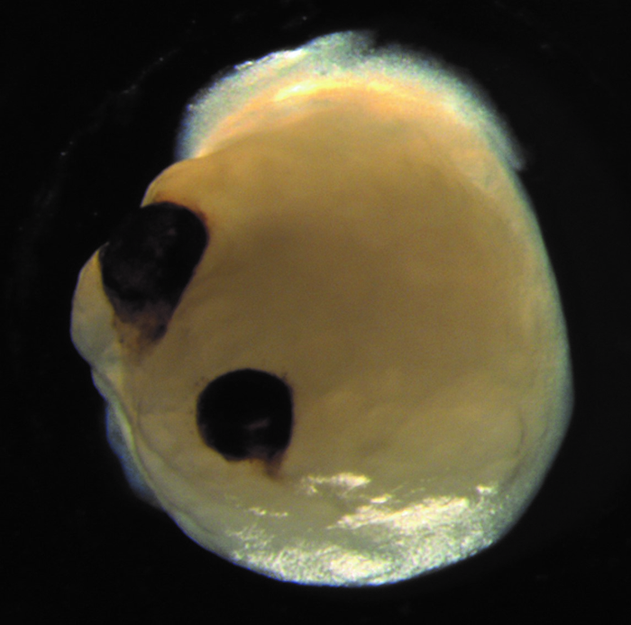 Brain organoid with optic cups