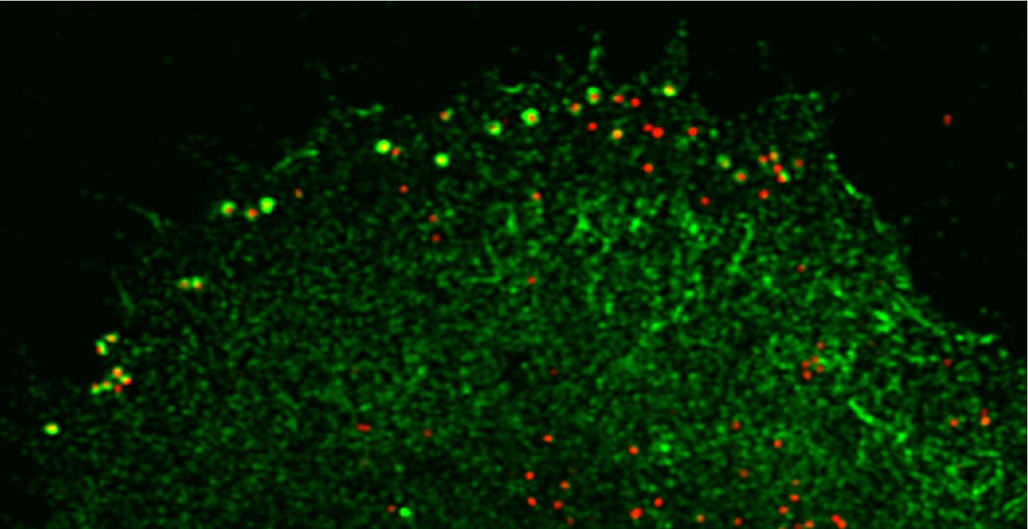 Vaccinia Viruses Can Be Trapped in Protein Cages