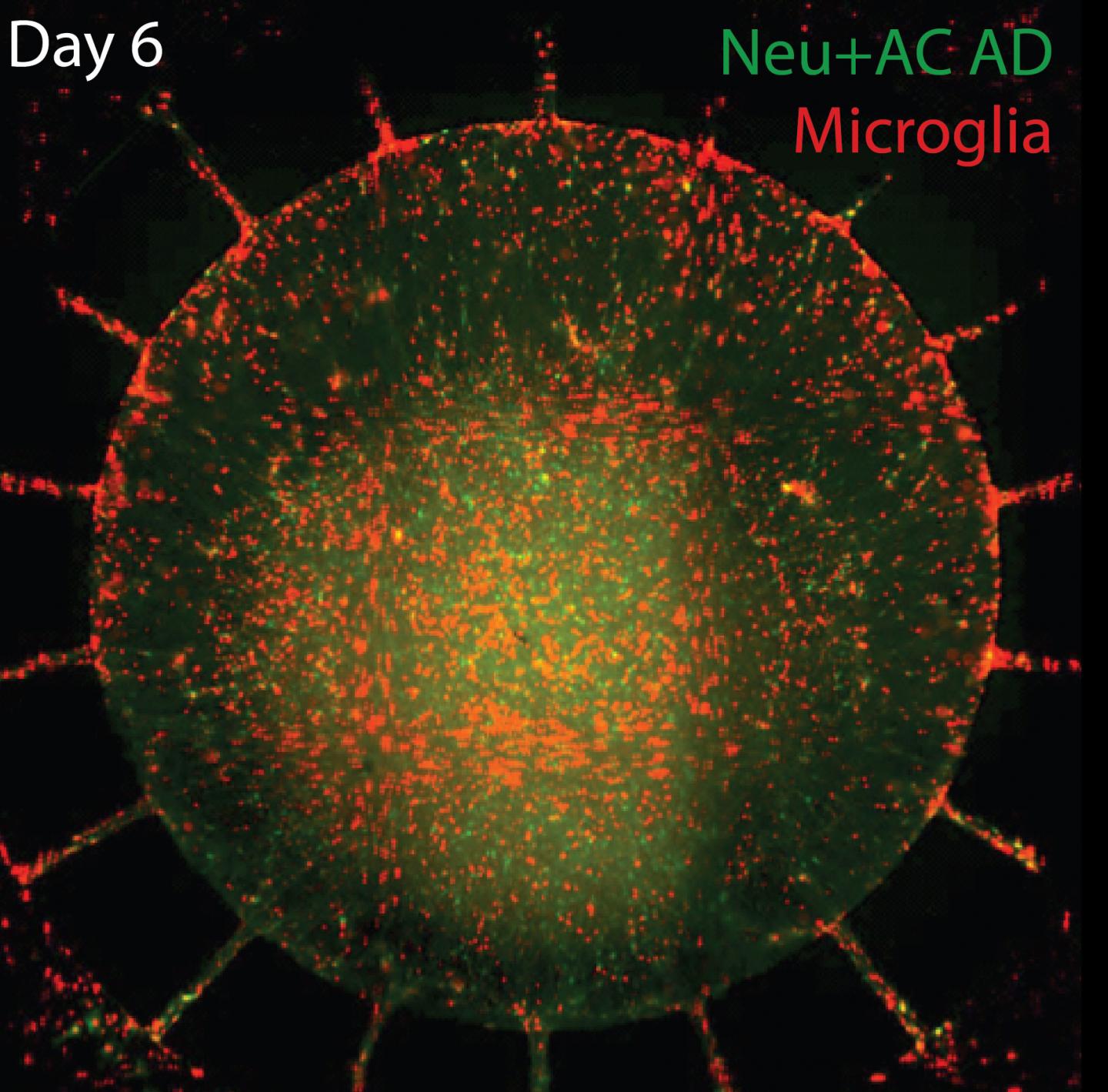 Triculture System Fully Replicates Alzheimer's Pathology