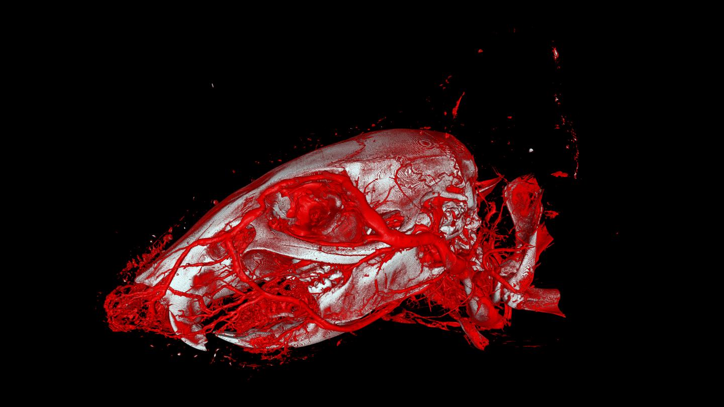 New contrast agent for X-ray computer tomography