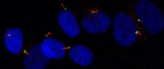Primary Cilia in Human Cartilage Cells