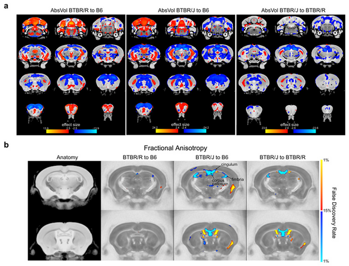 図1. MRIを用いたBTBR/JとBTBR/Rマウスの脳内構造の差異