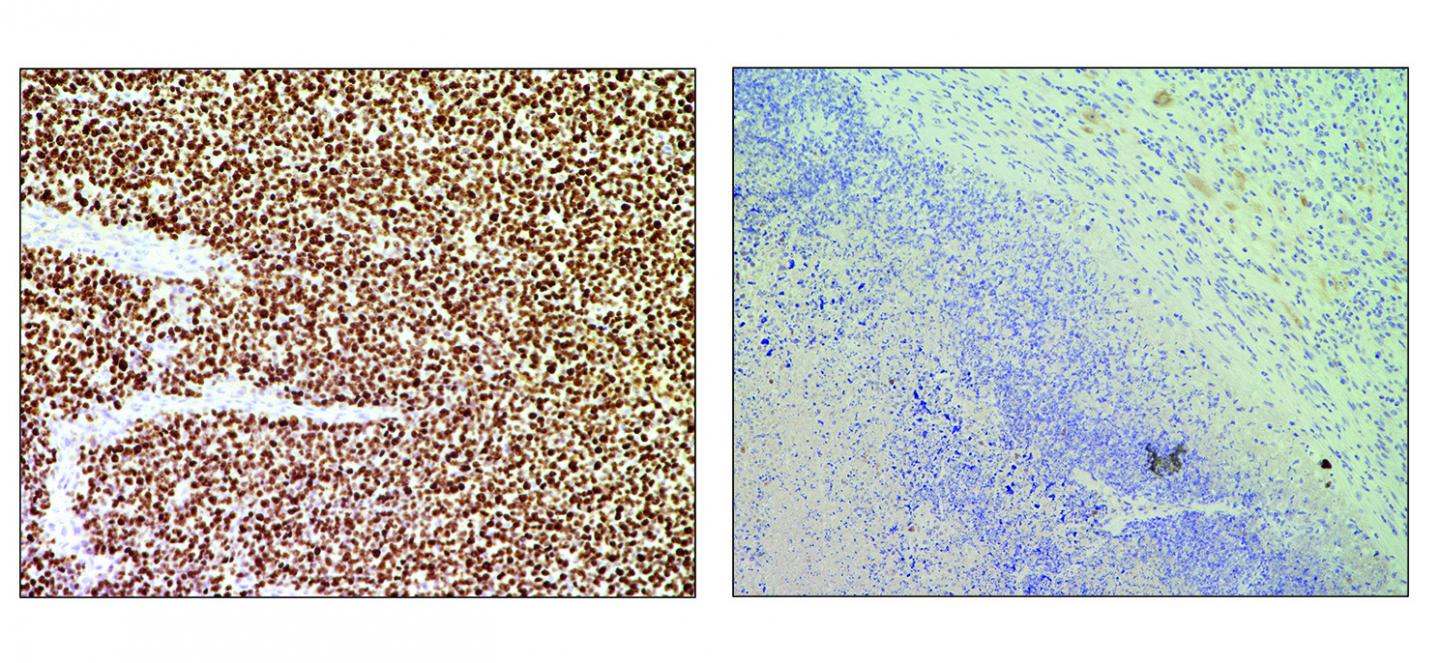 CRISPR and fusion genes, CNIO