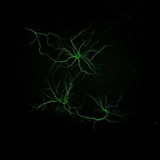 Neurons Culture