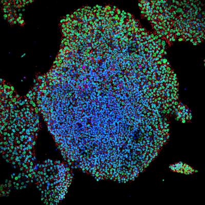 Stem Cells Engineered with 'Suicide Genes' Offer a Double Fail-Safe Approach