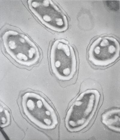 <i>Bacillus anthracis</i> Spores