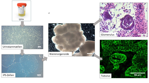 Kidney organoids from urine stem cells