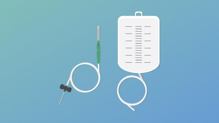 Foley Catheter Illustration