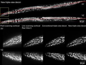Multiview Confocal Super-Resolution Microscopy: whole, fixed worm