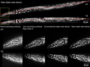 Multiview Confocal Super-Resol [VIDEO] | EurekAlert! Science News Releases