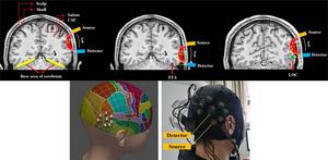 Functional near-infrared spectroscopy (fNIRS) can be performed using a portable emitter and detector placed on the scalp near a region of interest in the brain.