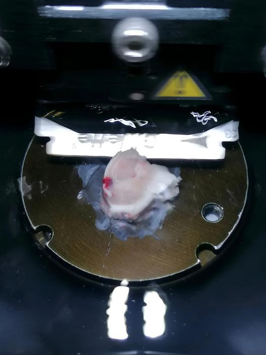 Human tissue block during slicing