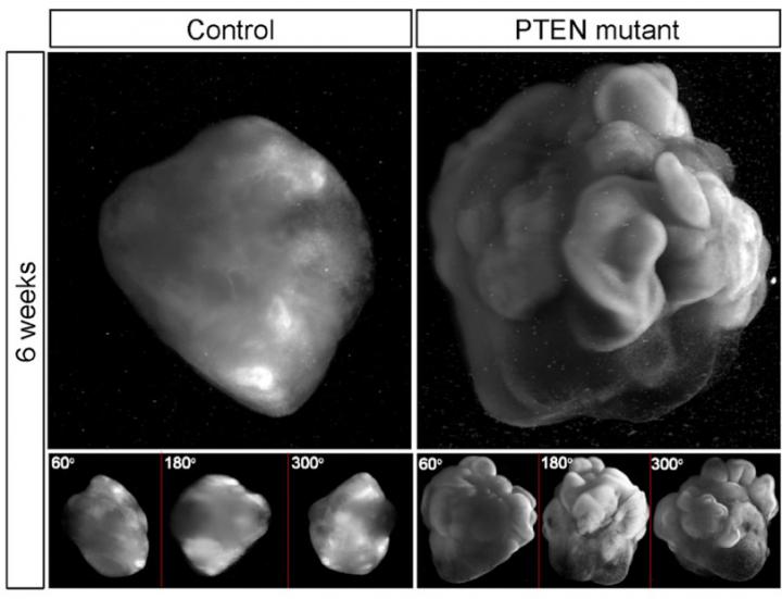 360 Degree Imaging of Human Brain Organoids