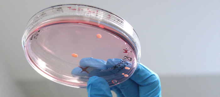 Lab-grown organoids