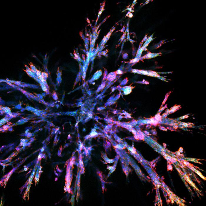 Pancreatic tumor organoid