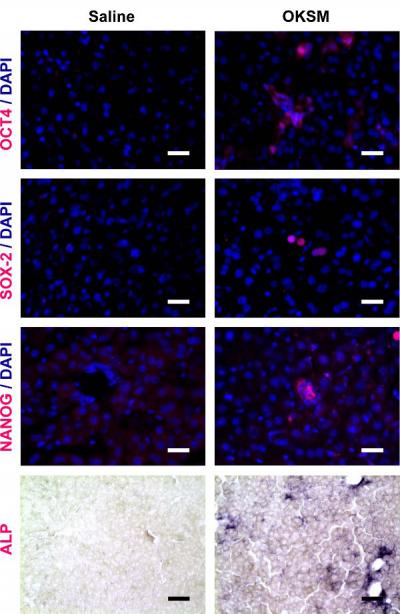 Visualizing Induced Pluripotent Stem Cells