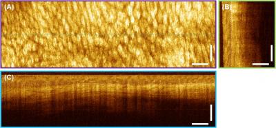 OCT Image of Excised Human Colon