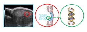 Ultrasound image of micro-histotripsy liberation of biomarkers in a tumor