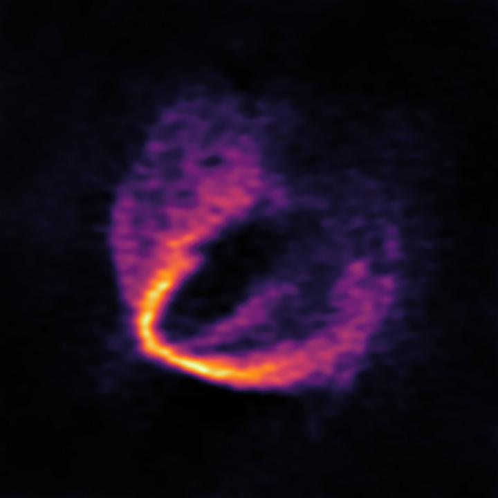ALMA Discovers Trio of Infant Planets