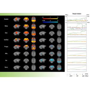 Resting state network (RSN) of the marmoset brain under different medications.