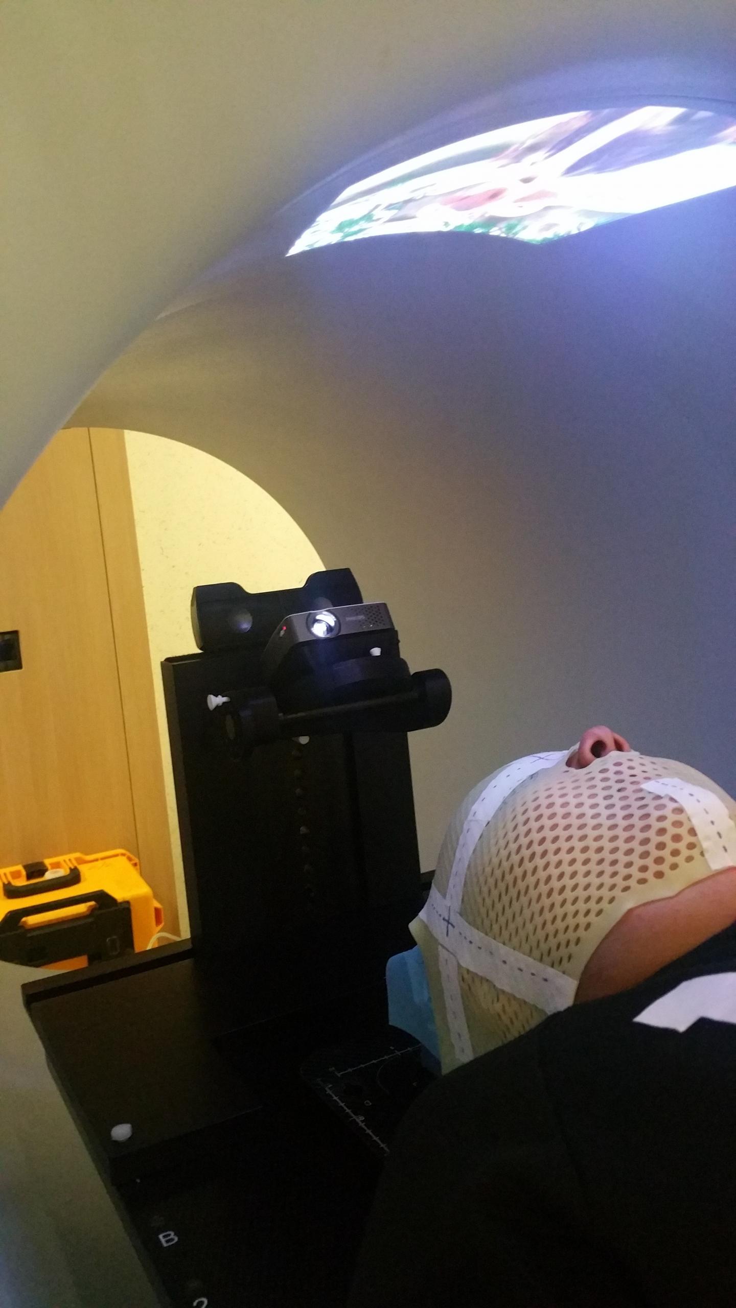 Child Watches a Movie While Undergoing Radiotherapy Treatment (1 of 3)