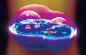 Spatial light interference microscopy of a cell