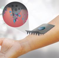 Painless and Biodegradable Microneedles on a Patch