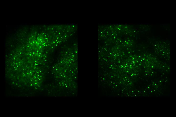 Inhibitory neurons