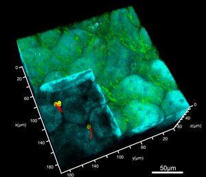 Imaging the dynamics of Candida albicans growth in the kidney of a living host