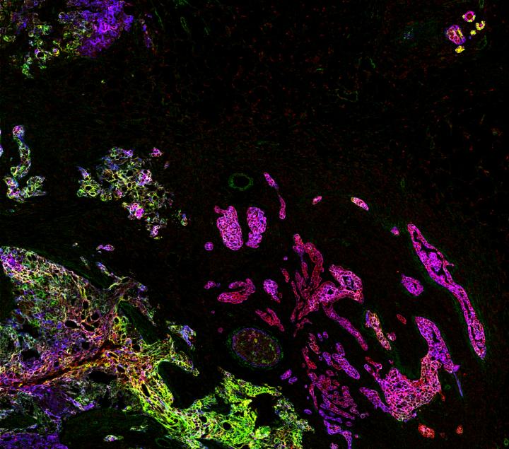 Simultaneous Visualization and Analysis of Multiple Biomarkers