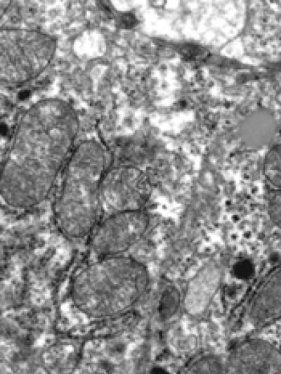 Healthy Mitochondria