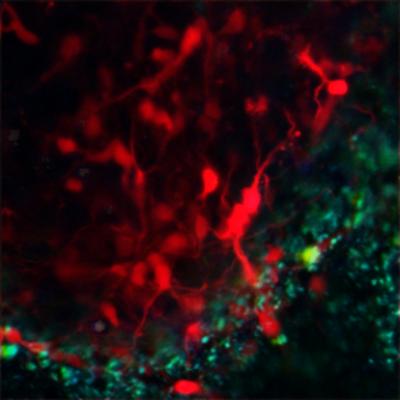 How Do Neural Cells Respond to Ischemia?