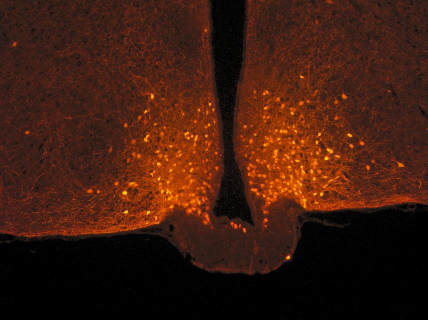 POMC Neurons (Orange Dots) in the Hypothalamus of a Mouse