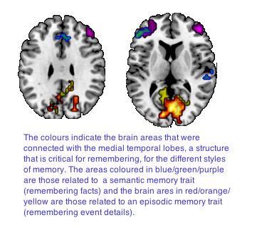 Memory Traits In Two Brains