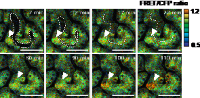 Visualization of cisplatin-induced necroptosis in proximal tubular epithelial cells.