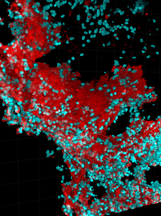 Pseudomonas aeruginosa biofilm