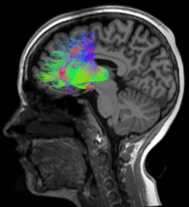 Mediodorsal thalamus and prefrontal cortex