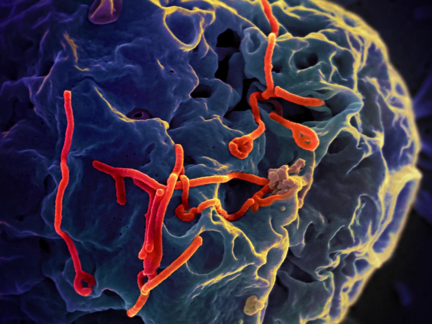 Ebola Virus on the Attack