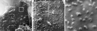 Helium ion microscope images of coronaviruses