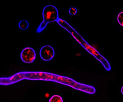 T. reesei hyphae microscopy