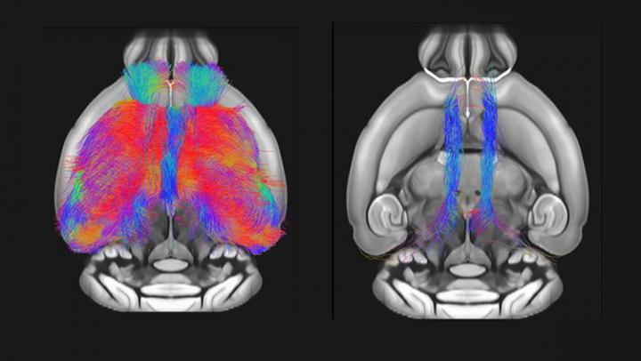Prefrontal Mis-wiring