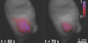 Delayed fluorescence as an imaging method for effective surgical tumor removal