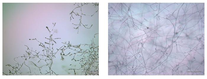 Oomycete, Globisporangium ultimum, on metalaxyl-containing medium