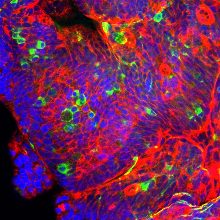 Enteroid Cultured in the Laboratory