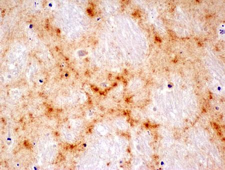 Brown Prion Proteins