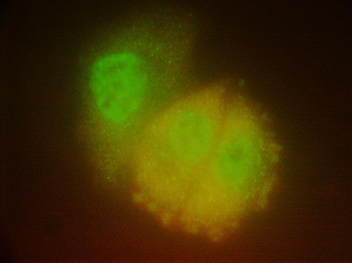 Neratinib-induced autophagy