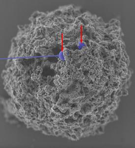 Nanoparticles in mast cells